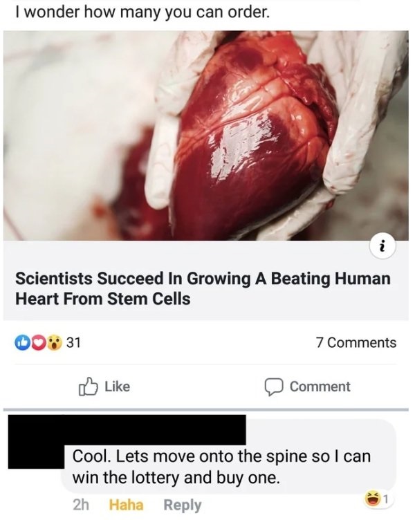 jaw - I wonder how many you can order. Scientists Succeed In Growing A Beating Human Heart From Stem Cells 0031 7 Comment Cool. Lets move onto the spine so I can win the lottery and buy one. 2h Haha