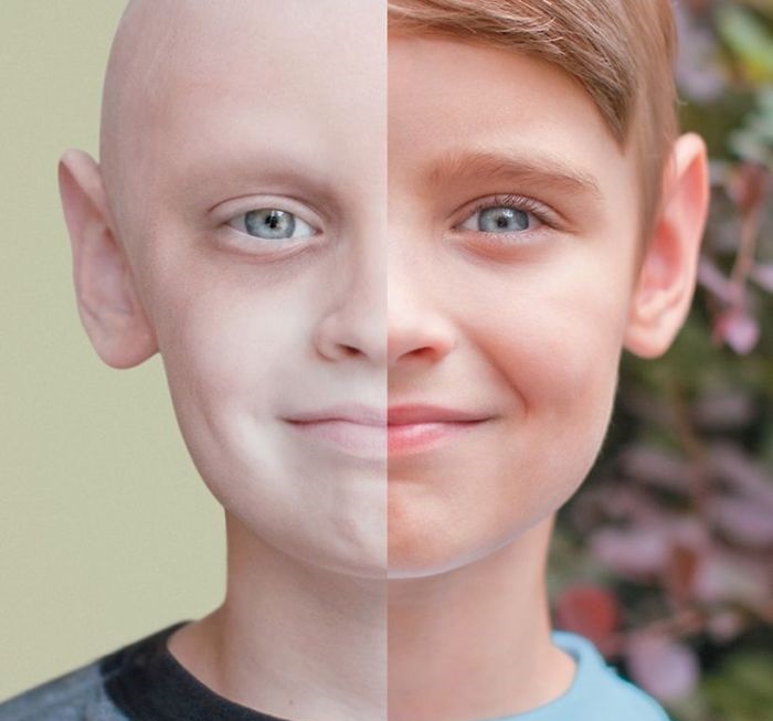 Cancer Patient vs. Cancer Survivor