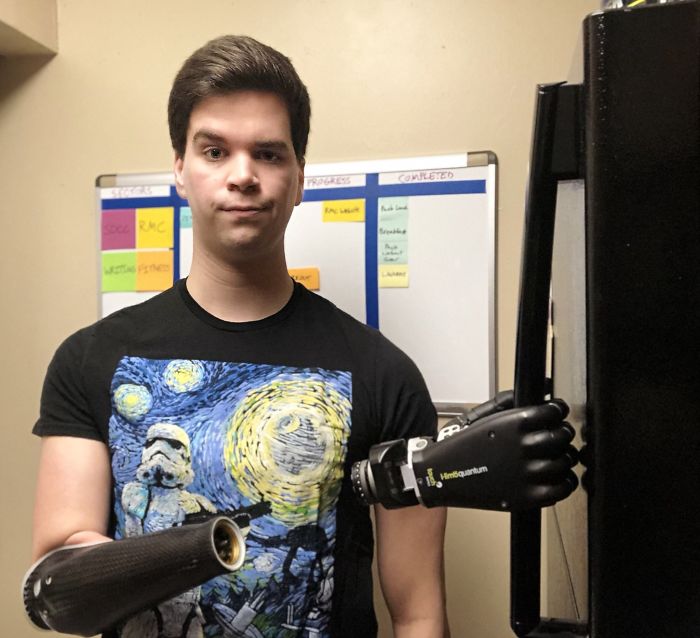 prosthetic hand on fridge