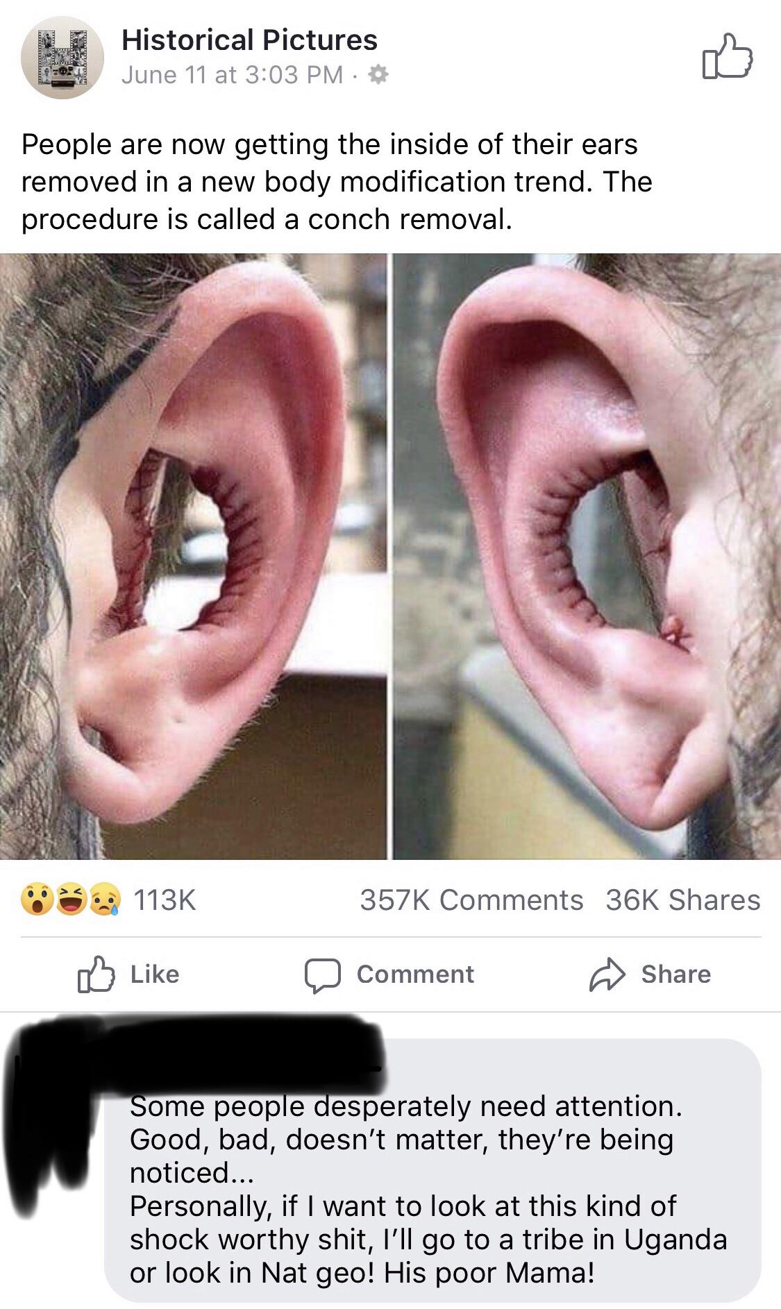 ear conch removal - Historical Pictures June 11 at . People are now getting the inside of their ears removed in a new body modification trend. The procedure is called a conch removal. 36K Comment Some people desperately need attention. Good, bad, doesn't 