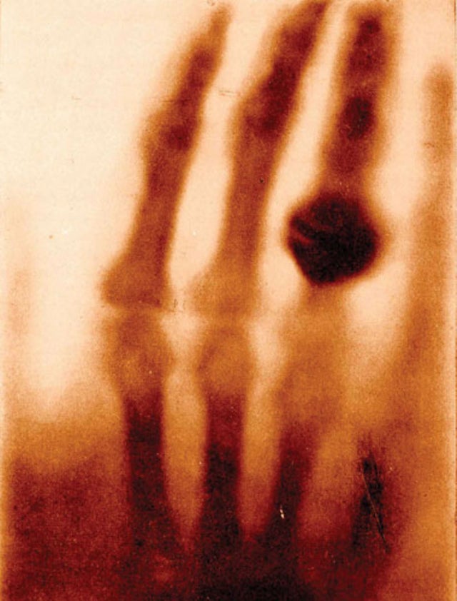 The first ever X-ray image, 1895.