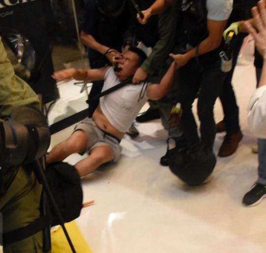 Hong Kong police attempt to extract a protester's eyeball.