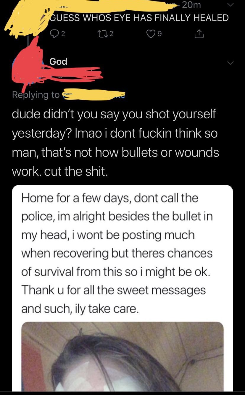 angle - 20m Guess Whos Eye Has Finally Healed God dude didn't you say you shot yourself yesterday? Imao i dont fuckin think so man, that's not how bullets or wounds work. cut the shit. Home for a few days, dont call the police, im alright besides the bull