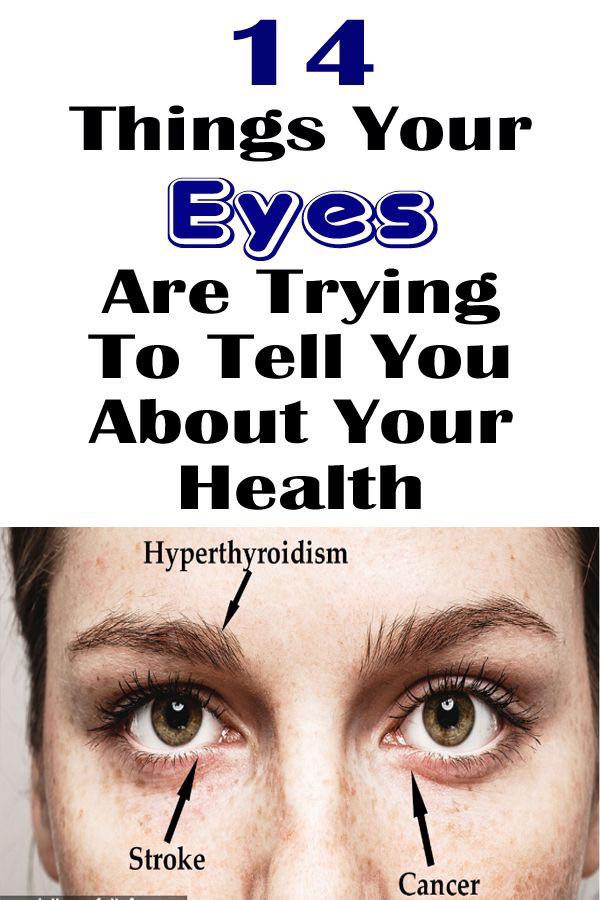 close up - 14 Things Your Eyes Are Trying To Tell You About Your Health Hyperthyroidism Stroke Cancer