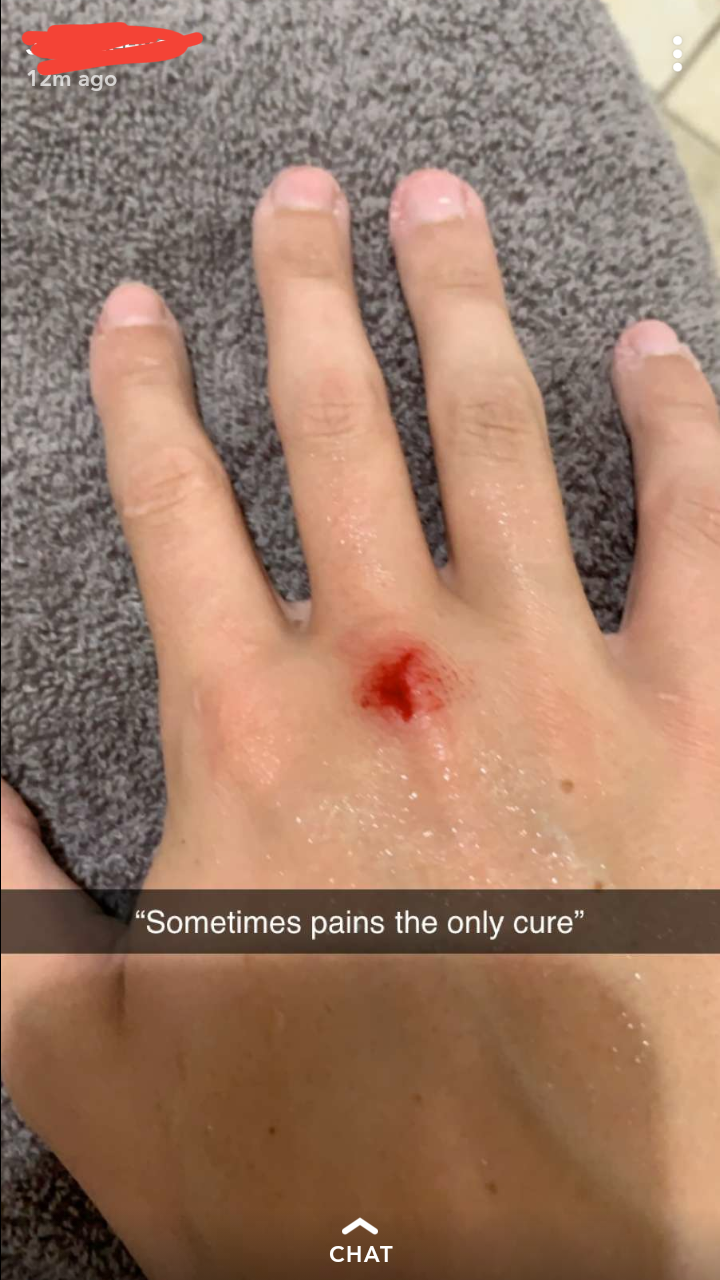 nail - Sometimes pains the only cure Chat