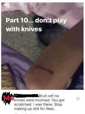 photo caption - Part 10... don't play with knives Uv Bruh wtf no knives were involved. You got scratched. I was there. Stop making up shit for .