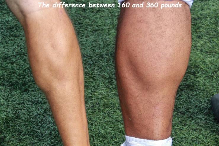 thigh - The difference between 160 and 360 pounds