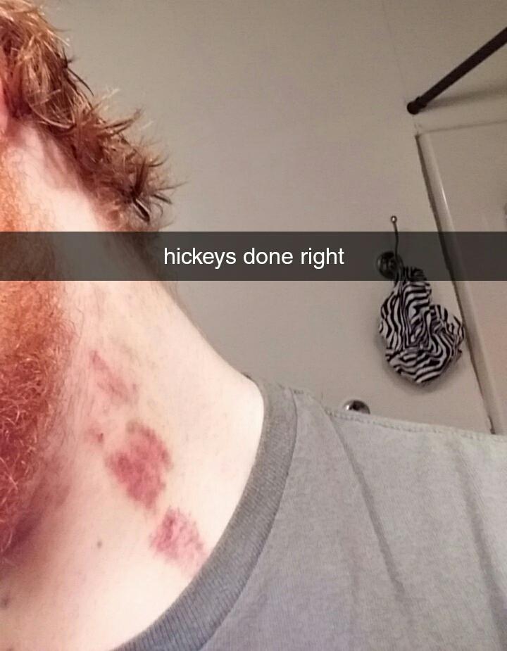 neck - hickeys done right
