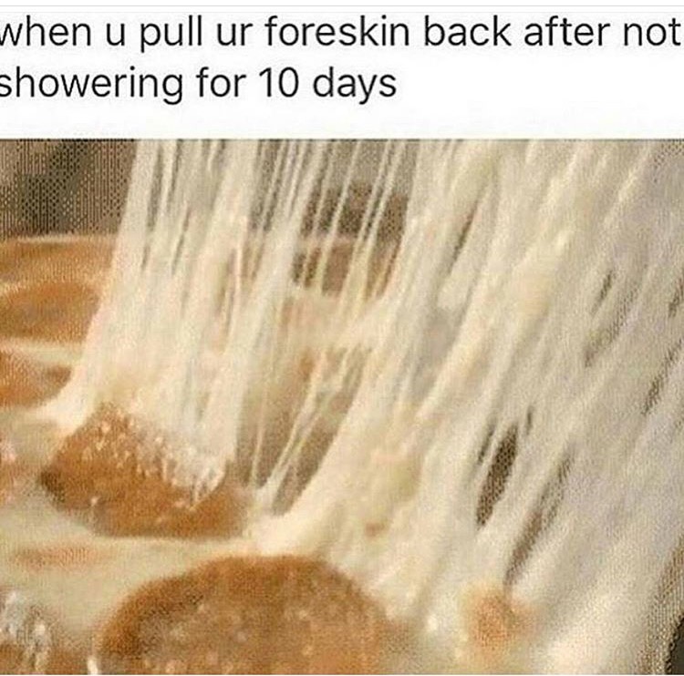 dick cheese - when u pull ur foreskin back after not showering for 10 days