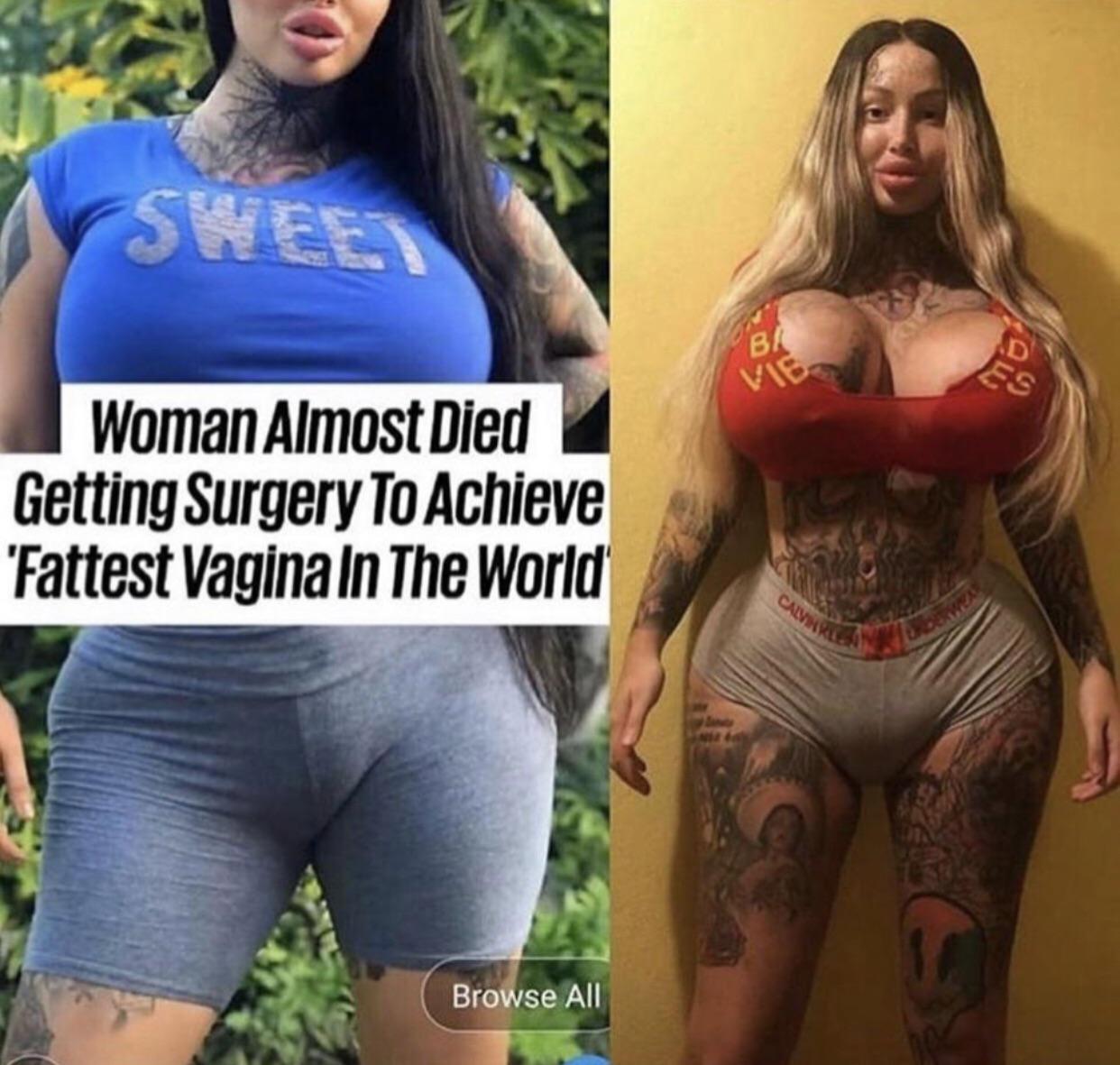 woman almost dies from fattest vagina - Woman Almost Died Getting Surgery To Achieve 'Fattest Vagina In The World Browse All