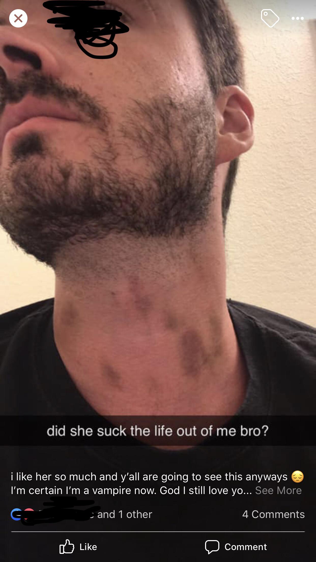 hickies on nck - did she suck the life out of me bro? i her so much and y'all are going to see this anyways I'm certain I'm a vampire now. God I still love yo... See More C and 1 other 4 Comment