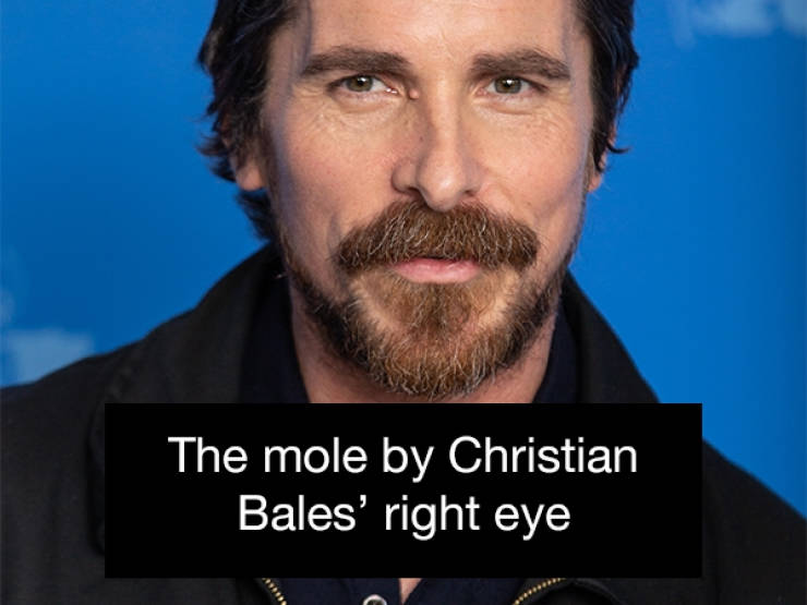 The mole by Christian Bales' right eye