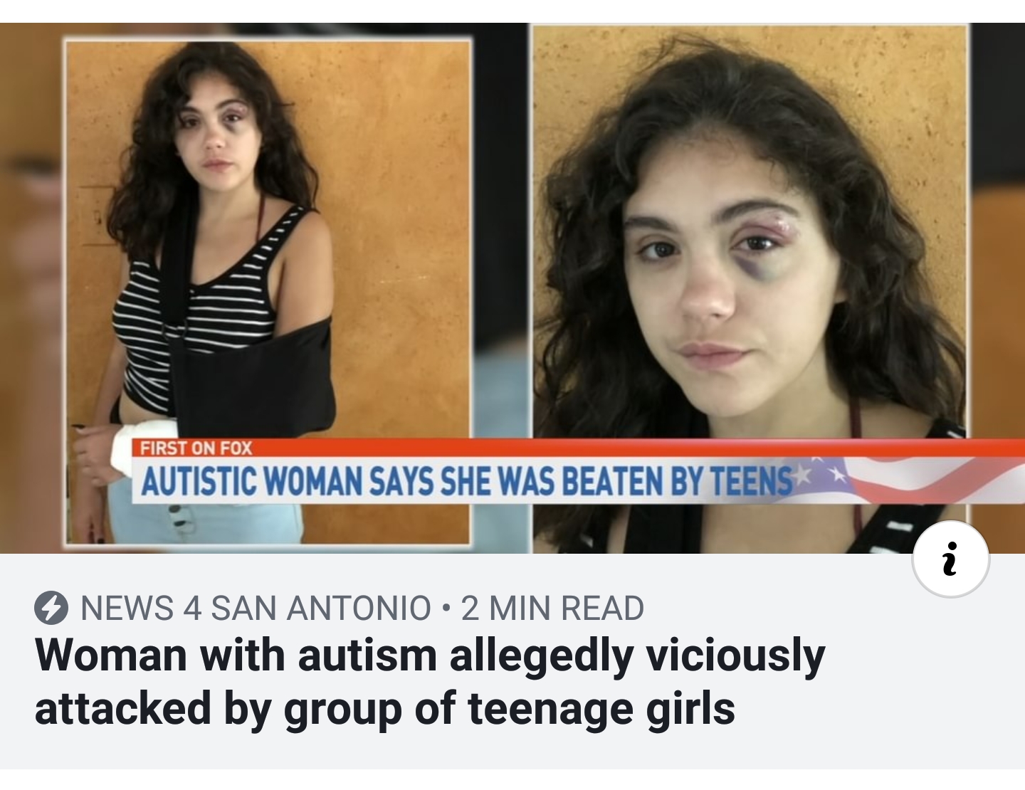 First On Fox Autistic Woman Says She Was Beaten By Teens News 4 San Antonio . 2 Min Read Woman with autism allegedly viciously attacked by group of teenage girls