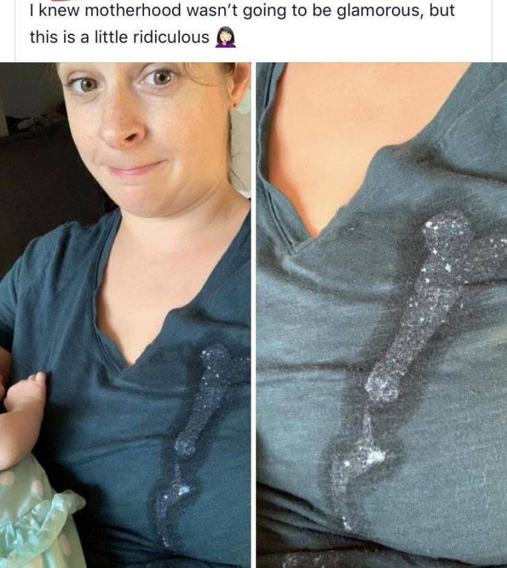 shoulder - I knew motherhood wasn't going to be glamorous, but this is a little ridiculous