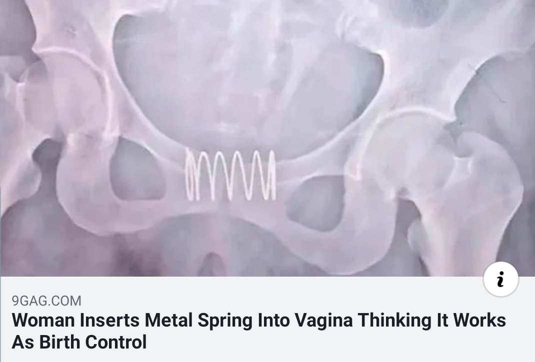 9GAG.Com Woman Inserts Metal Spring Into Vagina Thinking It Works As Birth Control