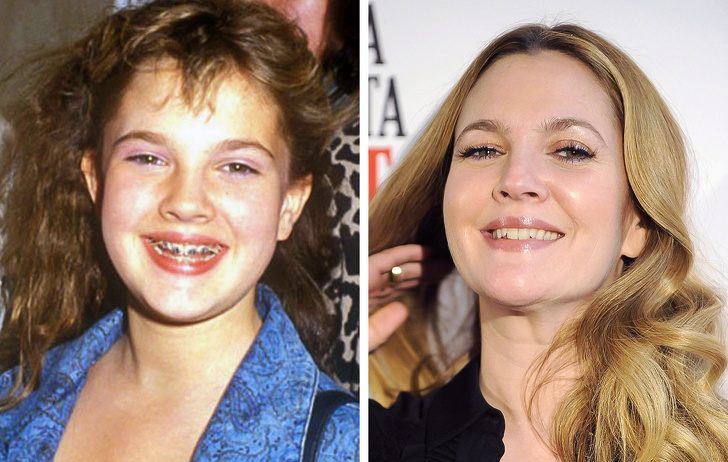 drew barrymore braces