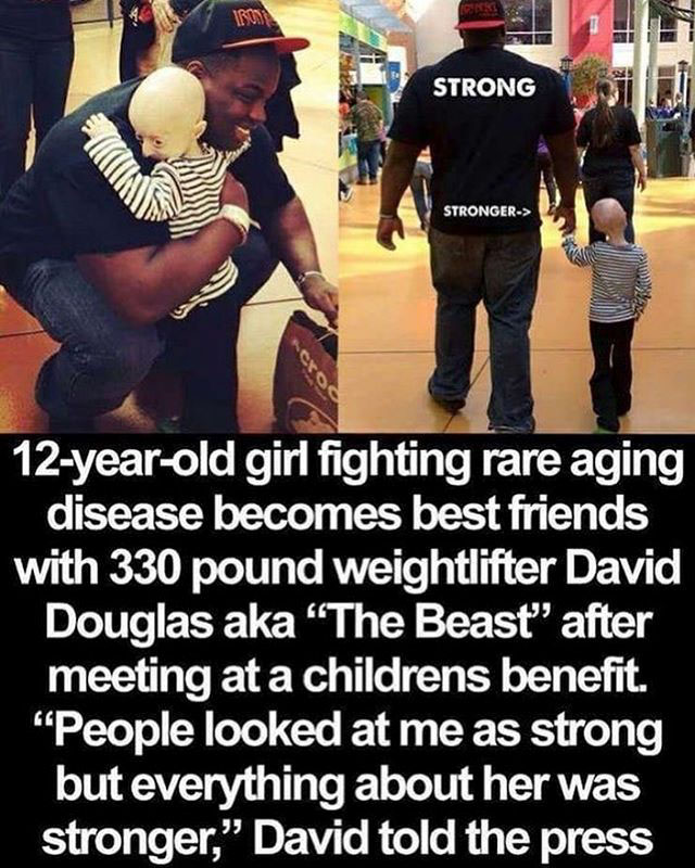 Disease - Strong Stronger> 12yearold girl fighting rare aging disease becomes best friends with 330 pound weightlifter David Douglas aka "The Beast" after meeting at a childrens benefit. "People looked at me as strong but everything about her was stronger