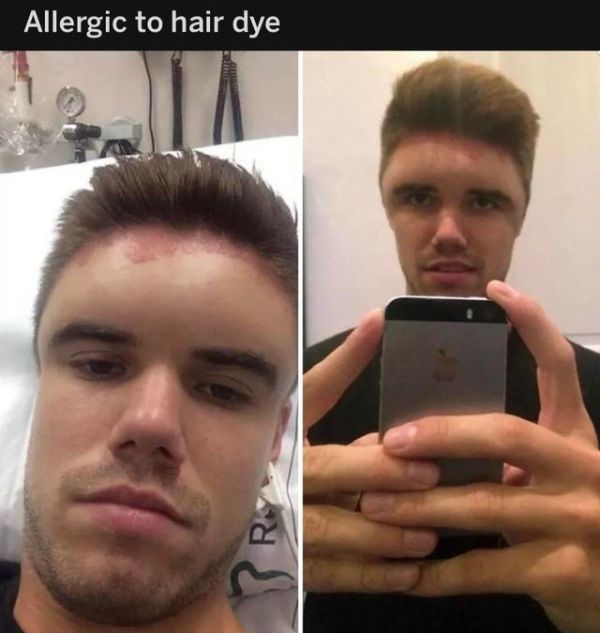 allergic to hair dye meme - Allergic to hair dye Ron