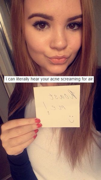 brutal roast me memes - I can literally hear your acne screaming for air