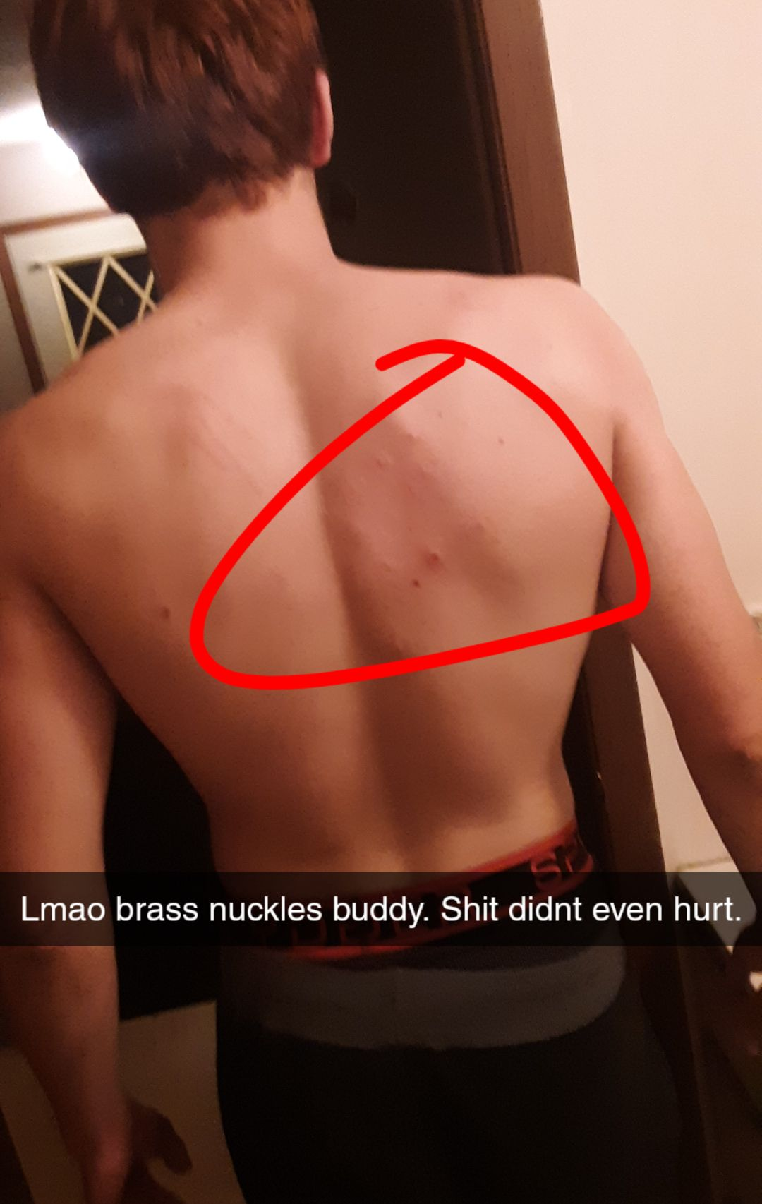 barechestedness - Lmao brass nuckles buddy. Shit didnt even hurt.
