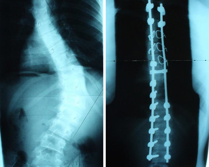 before and after medical radiography