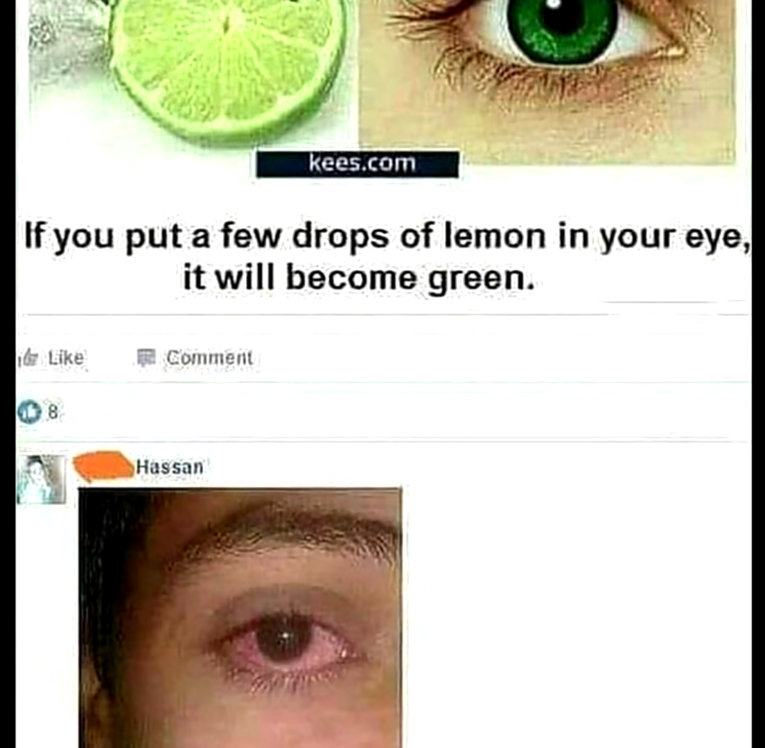 if you put a few drops of lemon in your eye - kees.com If you put a few drops of lemon in your eye, it will become green. Comment Hassan