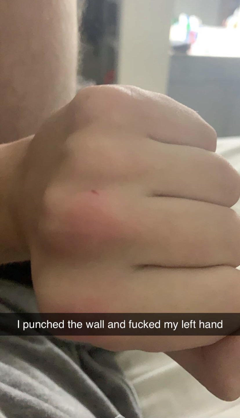 close up - I punched the wall and fucked my left hand