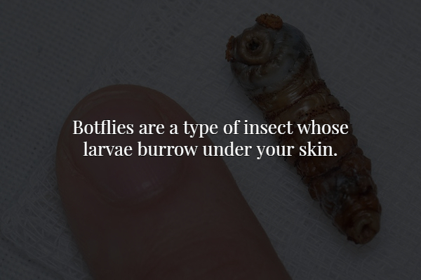 Botflies are a type of insect whose larvae burrow under your skin.