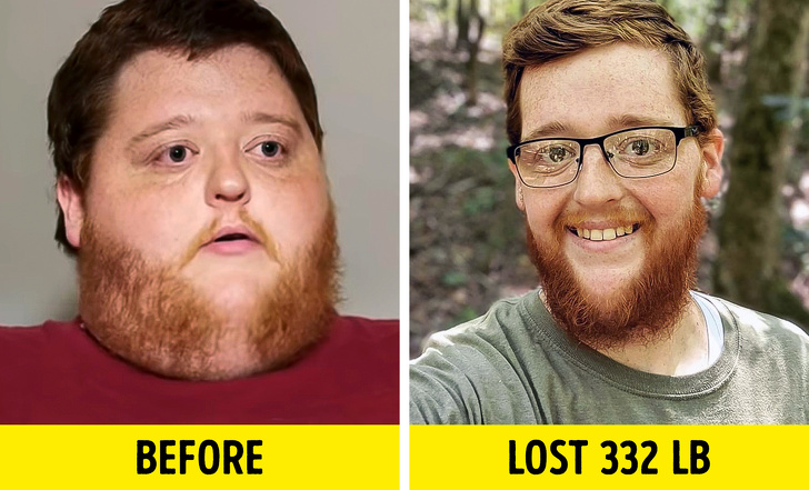 beard - Before Lost 332 Lb