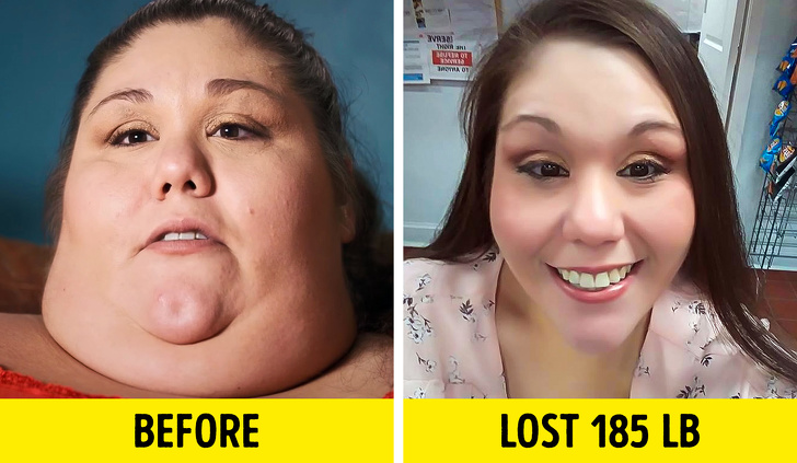 alicia my 600 pound life - Vram Before Lost 185 Lb