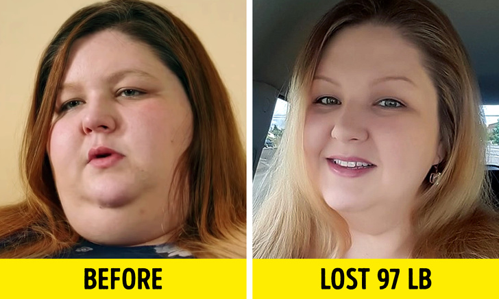 jaw - Before Lost 97 Lb