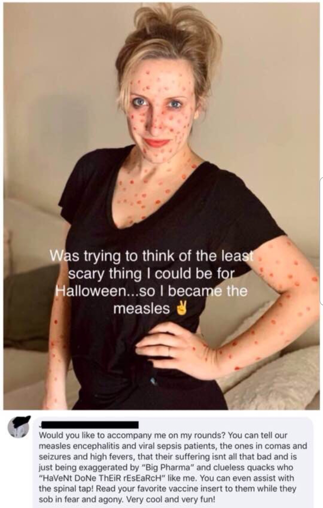 shoulder - Was trying to think of the least scary thing I could be for Halloween...so I became the measles Would you to accompany me on my rounds? You can tell our measles encephalitis and viral sepsis patients, the ones in comas and seizures and high fev
