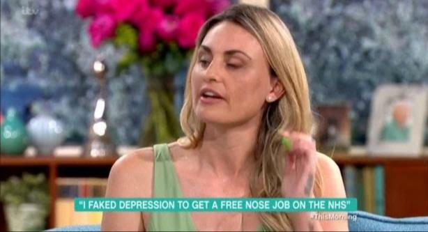 carla bellucci before - "I Faked Depression To Get A Free Nose Job On The Nhs" This Morning