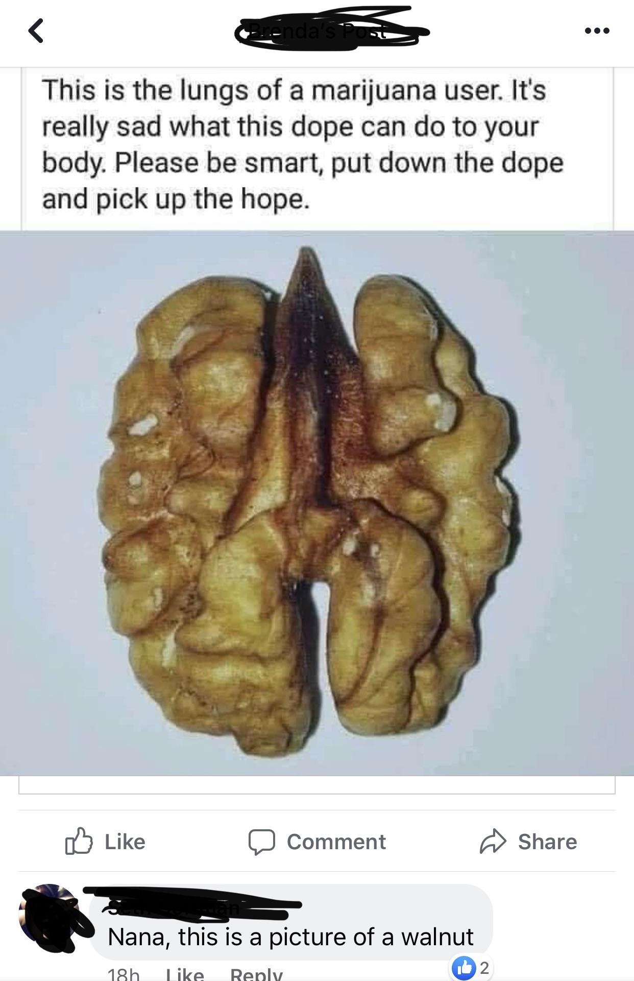 lungs of a marijuana user - 2.nda's Post This is the lungs of a marijuana user. It's really sad what this dope can do to your body. Please be smart, put down the dope and pick up the hope. D Comment Nana, this is a picture of a walnut 18h 2