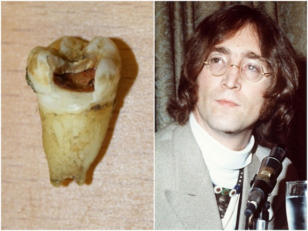 john lennon tooth