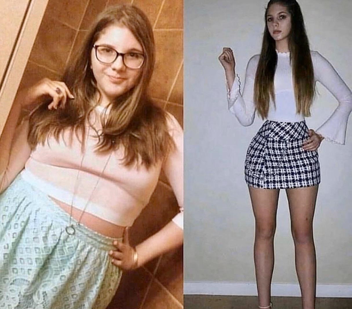 girl before and after weight loss