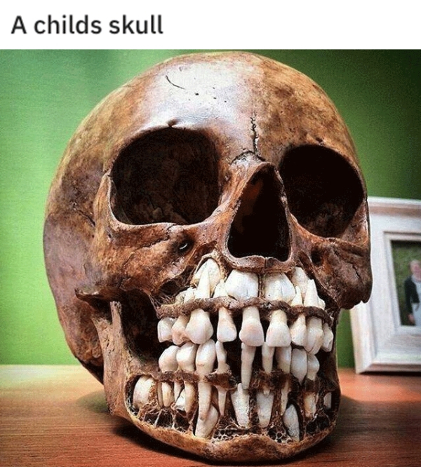 childs skull - A childs skull