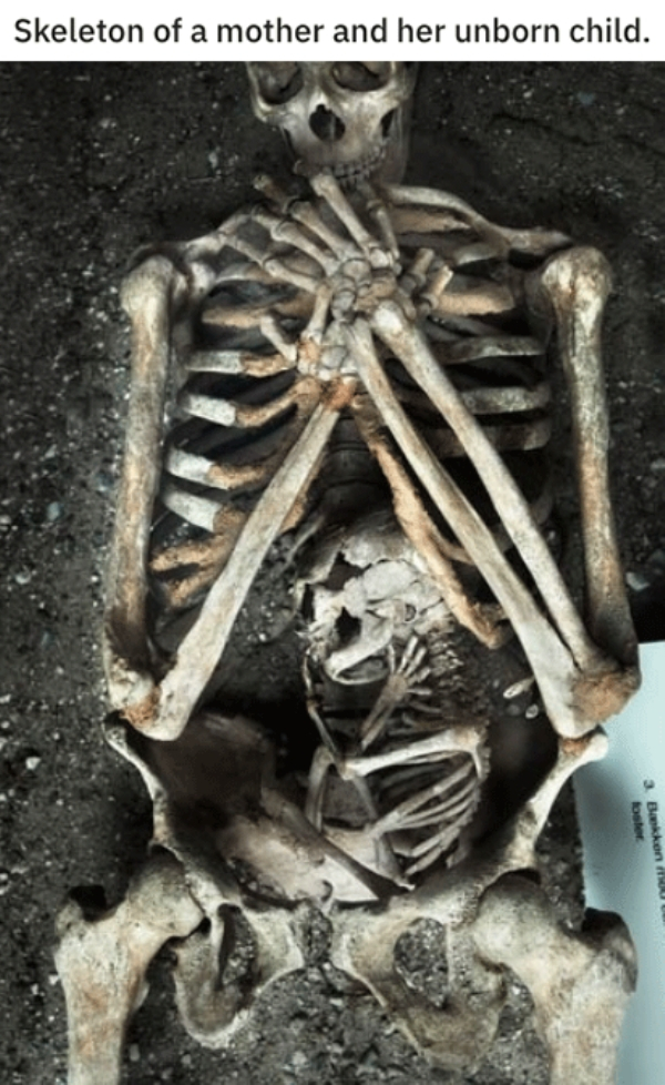pregnant woman skeleton - Skeleton of a mother and her unborn child.