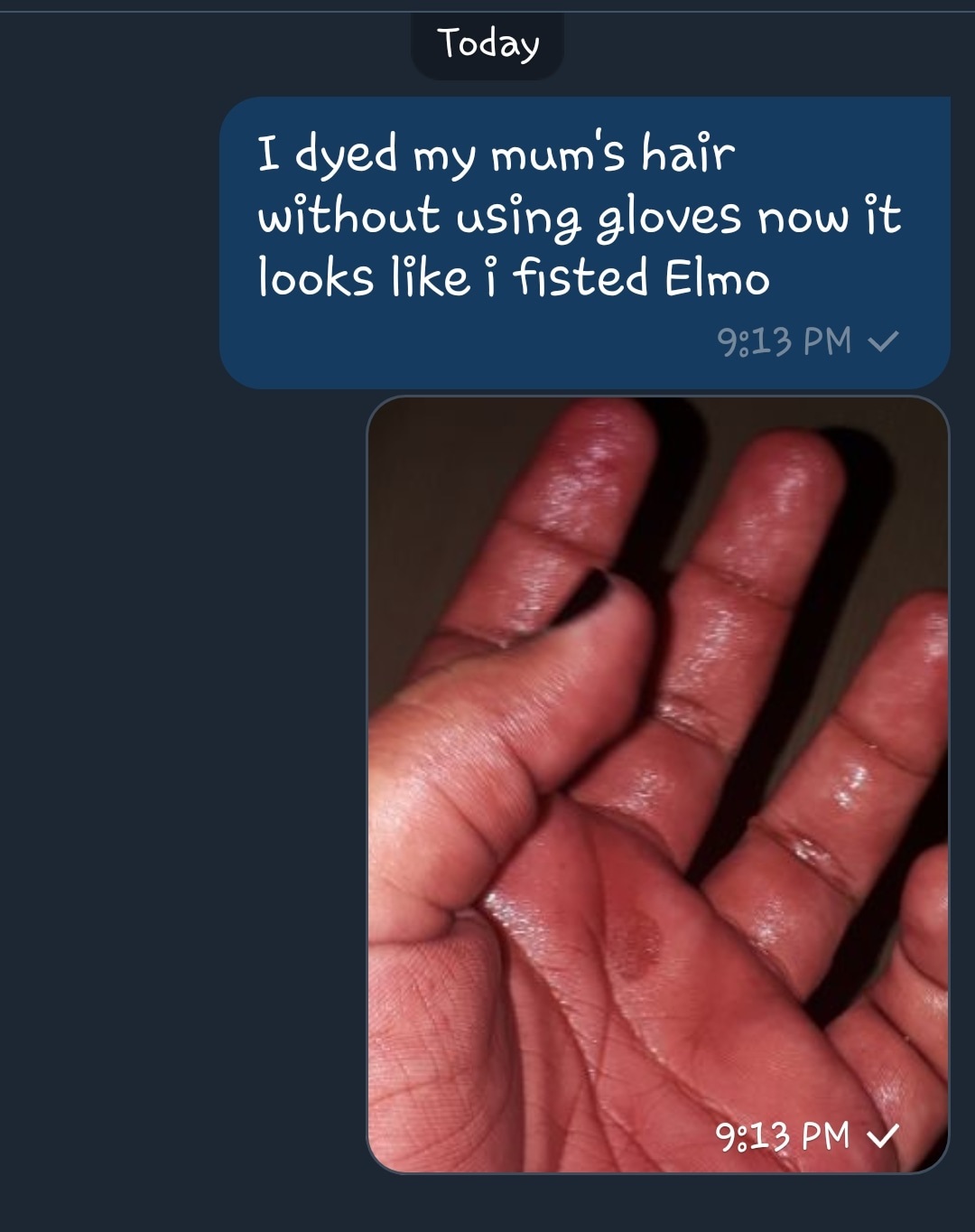 hand model - Today I dyed my mum's hair without using gloves now it looks i fisted Elmo v