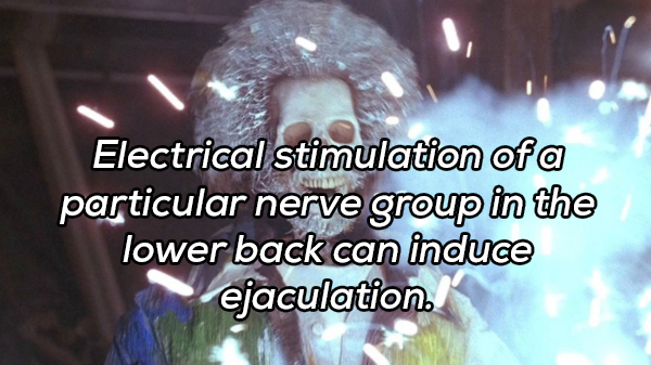 photo caption - Electrical stimulation of a particular nerve group in the lower back can induce ejaculation