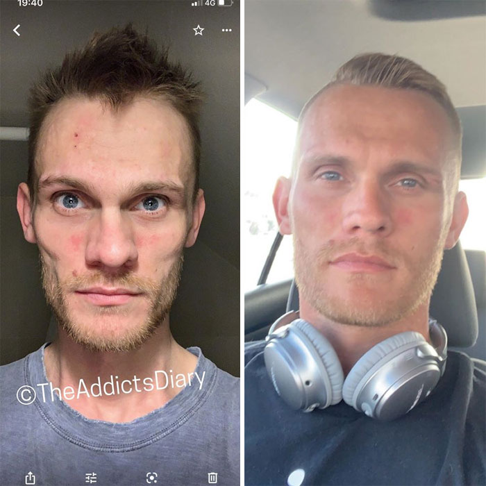 before and after drugs - 1146 TheAddictsDiary