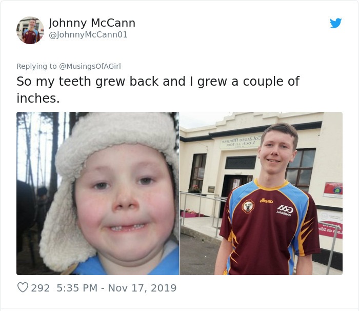 photo caption - Johnny McCann McCann01 So my teeth grew back and I grew a couple of inches. Jos no no 292