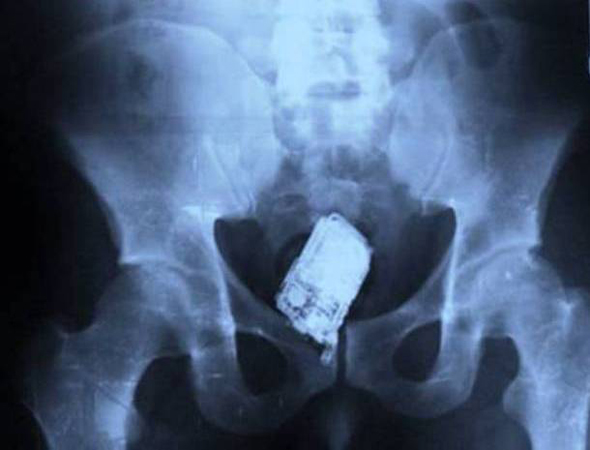 mobile phone x ray