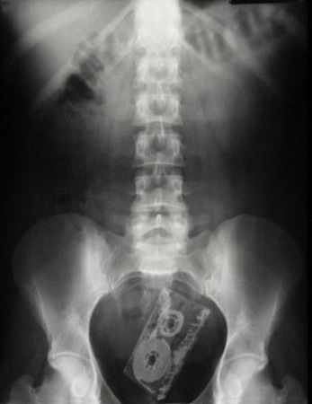 interesting x rays