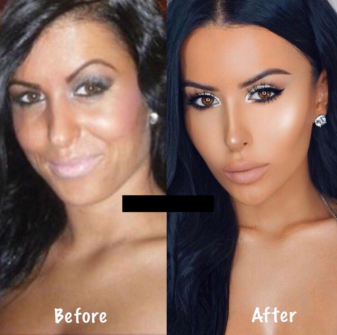amrezy before and after - Before After