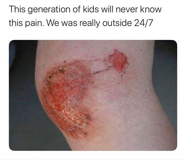 neck - This generation of kids will never know this pain. We was really outside 247