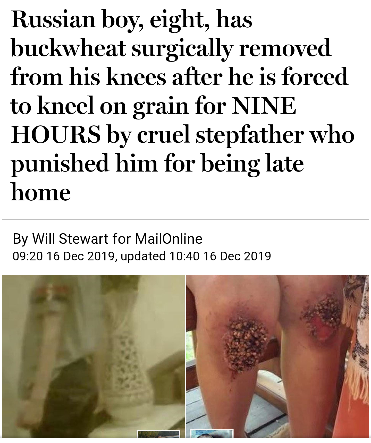 ephesians 2 8 10 - Russian boy, eight, has buckwheat surgically removed from his knees after he is forced to kneel on grain for Nine Hours by cruel stepfather who punished him for being late home By Will Stewart for MailOnline , updated