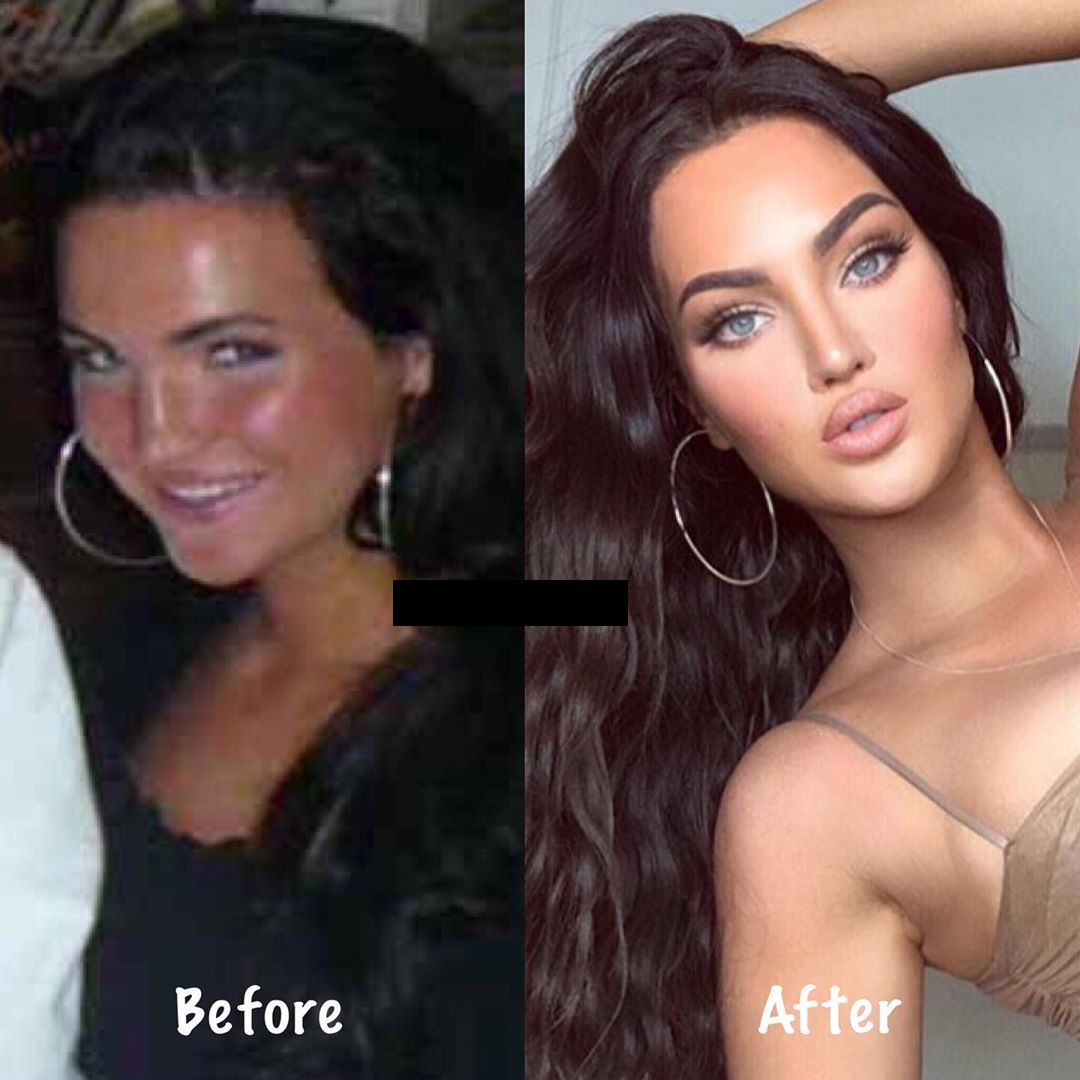 beauty - Before After