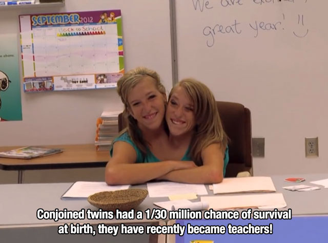 Conjoined twins - We uve qui Cool great year! !! Conjoined twins had a 130 million chance of survival at birth, they have recently became teachers!