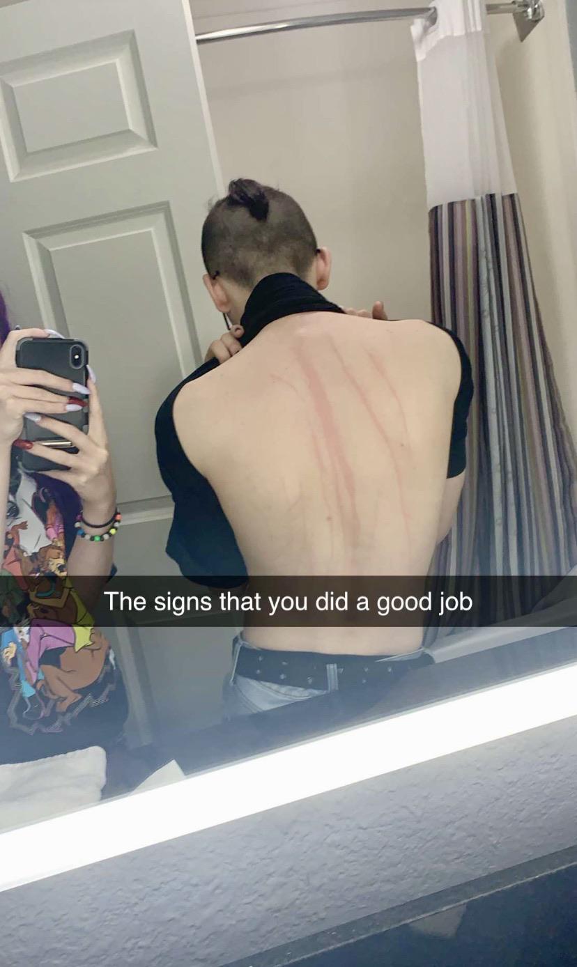 shoulder - The signs that you did a good job